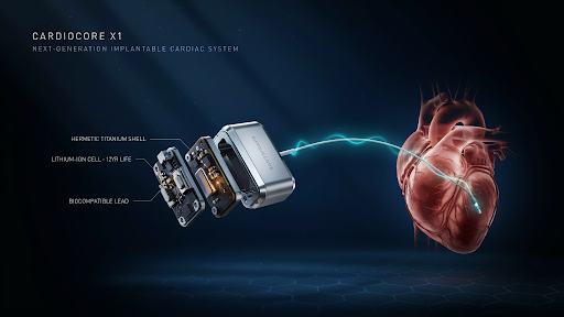 An example of 3D medical device animation